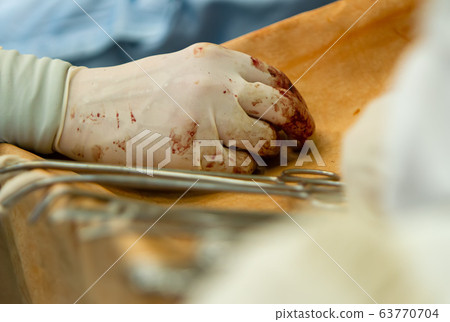 close-up of the assistant surgeon's hand. 63770704