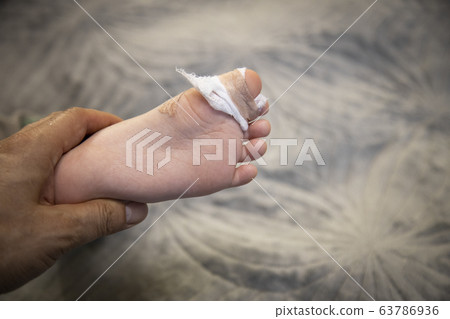 腳受傷的孩子 腳受傷的孩子 63786936