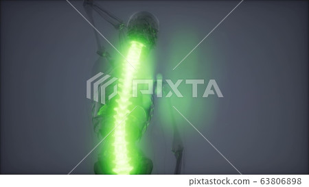 Backache in Back Bones Backache in Back Bones 63806898