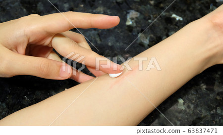 Hand applying white medication cream to a red wound scar on the arm. 63837471