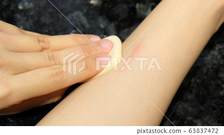 Hand with a sponge applicator pad trying to conceal a red wound scar on the arm. 63837472