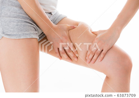 Thigh cellulite / young woman 63873709