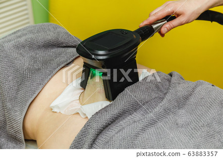 Woman getting cryolipolysis fat treatment 63883357