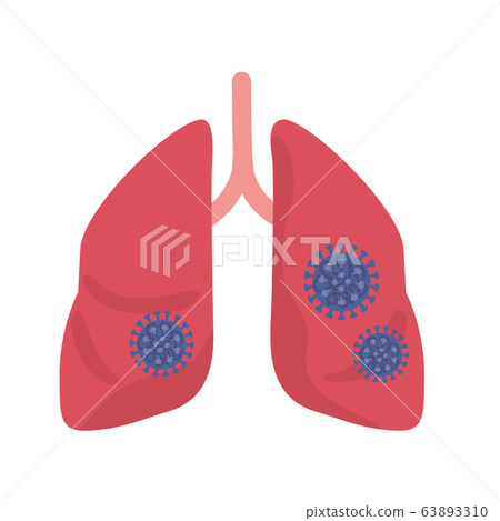 肺與病毒感染圖 肺與病毒感染圖 63893310
