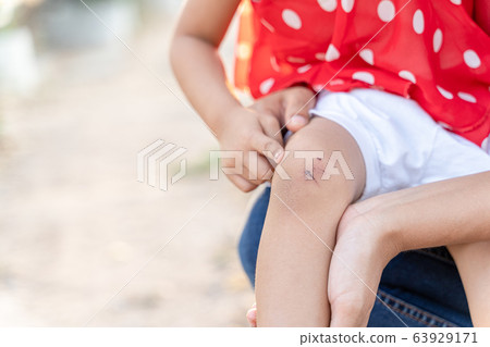 A girl with a knee pain and her abrasion. A girl with a knee pain and her abrasion. 63929171