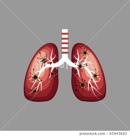 Global epidemic alert.  COVID-19 outbreak.Virus epidemic.Virus COVID-19 to spread into the cells of the airways and lungs.  Vector illustration isolated on gray  background. 63943683