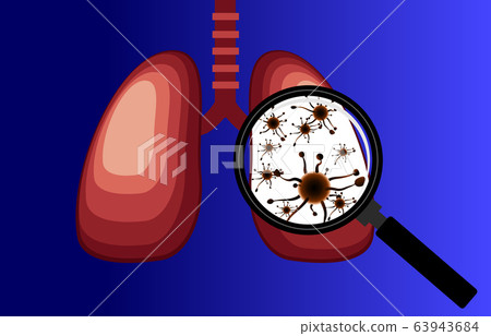 Virus and bacteria infected the Human lungs. lung disease,Magnifier detects lung virus,Isolated blue background - Vector 63943684