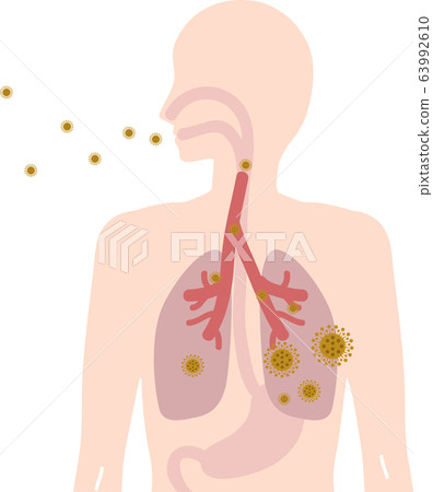 Image of absorbing and coughing virus 63992610
