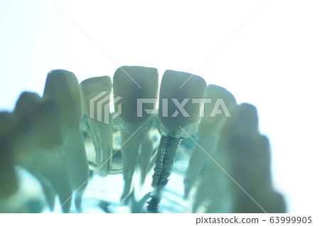 Dental tooth model 63999905