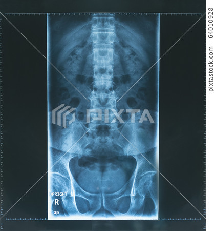 X-ray image human spine APl view in blue tone. 64010928