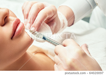 lip shape correction procedure in a cosmetology salon. The specialist makes an injection on the lips of the patient. Lip augmentation lip shape correction procedure in a cosmetology salon. The specialist makes an injection on the lips of the patient. Lip augmentation 64020097