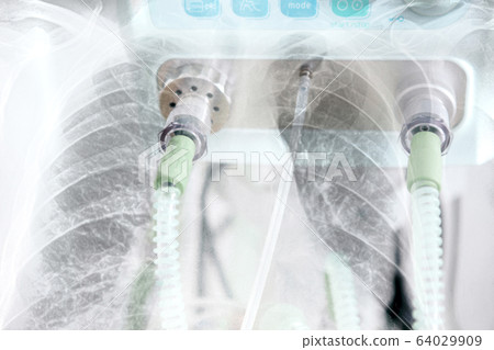 Double exposure of x-ray image of lung with 64029909
