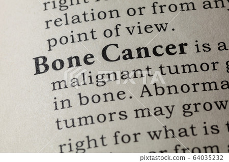 definition of Bone Cancer definition of Bone Cancer 64035232