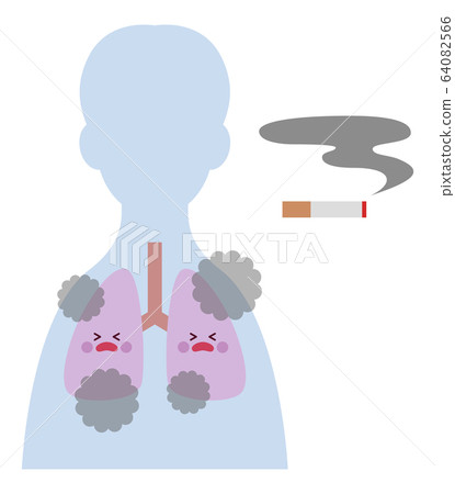 Lung of smoker (male) Lung of smoker (male) 64082566