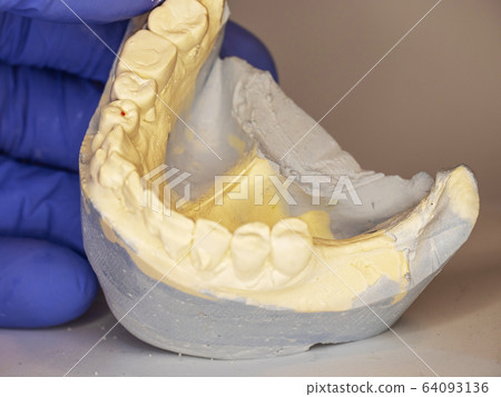 Dental gypsum mold with crooked teeth. Dental gypsum mold with crooked teeth. 64093136