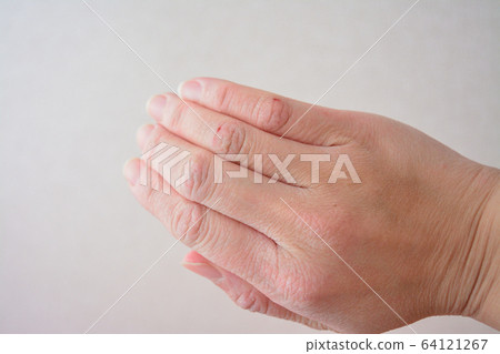 Woman's dry hands 64121267