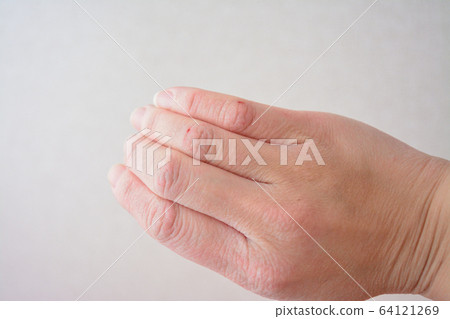 Woman's dry hands 64121269