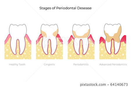 Vector isolated illustration of tooth Vector isolated illustration of tooth 64140673