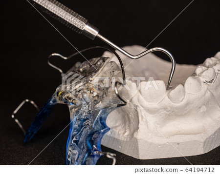 Temporary retainers on white plaster cast. Temporary retainers on white plaster cast. 64194712