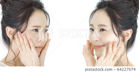 Skin Care Before After 64227074