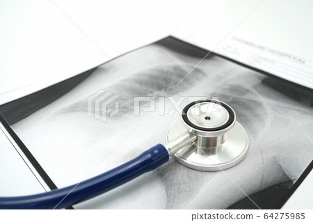 Lung x-ray To check for Covid 19 viruses or 64275985