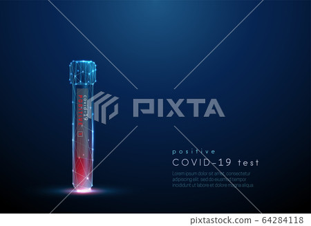 Blood test tube. Positive result coronavirus test Blood test tube. Positive result coronavirus test 64284118