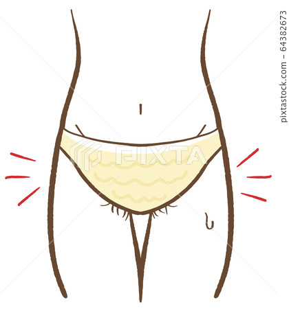 Illustration of hair removal V line waste hair 64382673