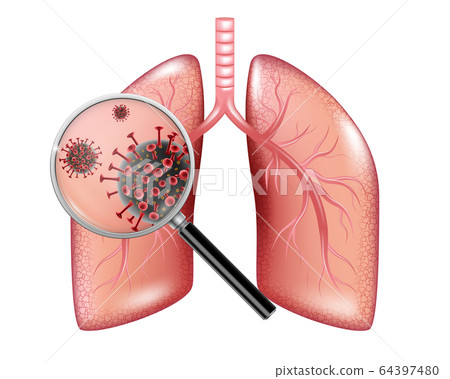 Realistic Corona virus outbreak. Coronavirus banner with infected lungs and magnifying glass isolated on white. Vector 64397480