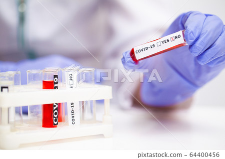 Doctor holds test tube with covid-19 test. 64400456