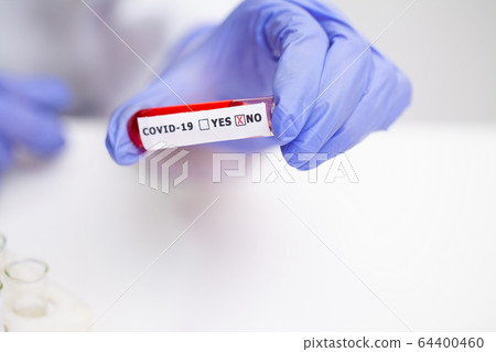 Doctor holds test tube with covid-19 test. 64400460