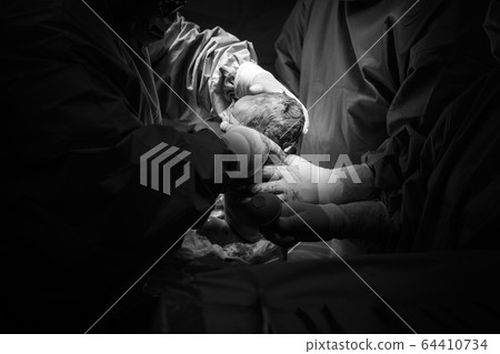 Cesarean section the operation is in process. 64410734