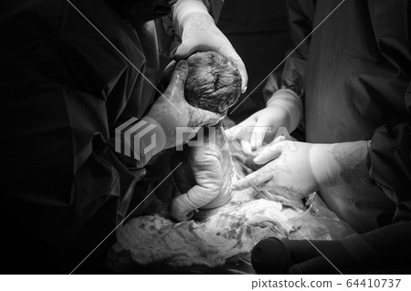 Cesarean section the operation is in process. 64410737