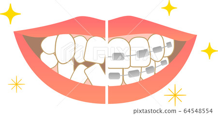 Tooth alignment Dental care Before orthodontic treatment After treatment Tooth alignment Dental care Before orthodontic treatment After treatment 64548554
