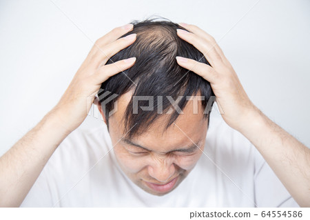 中年男子遭受稀薄的頭髮 中年男子遭受稀薄的頭髮 64554586