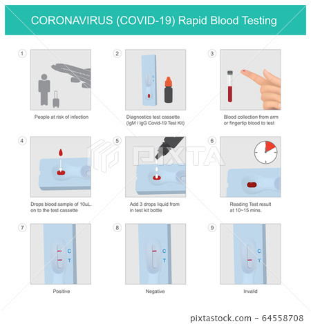 CORONAVIRUS Rapid Blood Testing. The method used CORONAVIRUS Rapid Blood Testing. The method used 64558708
