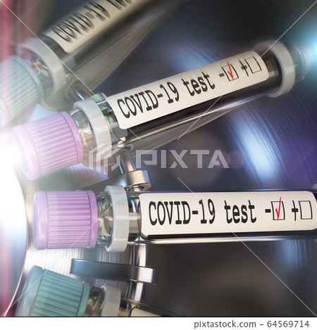 Negative COVID-19 test and laboratory sample of blood testing for diagnosis new Corona virus infection novel corona virus disease 2019 from Wuhan. Pandemic infectious concept 3D Negative COVID-19 test and laboratory sample of blood testing for diagnosis new Corona virus infection novel corona virus disease 2019 from Wuhan. Pandemic infectious concept 3D 64569714