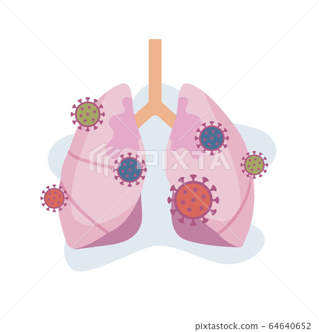 Lung, virus, infection, pneumonia, covid-19, corona, illustration, vector 64640652