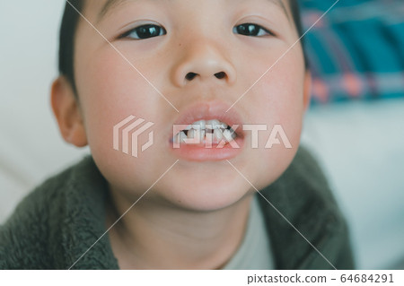 milk teeth, replaced, tooth 64684291