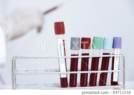 The picture of blood tube and doctor's hand The picture of blood tube and doctor's hand 64711530