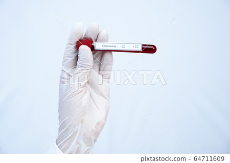 Doctor hand holding blood tube and recording the Doctor hand holding blood tube and recording the 64711609