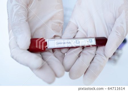 Doctor hand holding blood tube and recording the Doctor hand holding blood tube and recording the 64711614