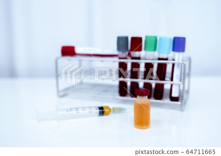 The picture of yellow serum tube and blood tube of 64711665