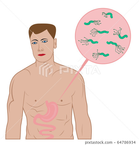 Stop helicobacter in stomach sign 64786934