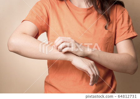 Women scratch itchy arm with hand. 64812731