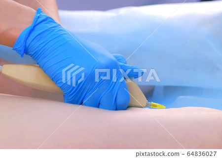 Doctor making injection carbon dioxide on woman leg on carboxytherapy, closeup. 64836027