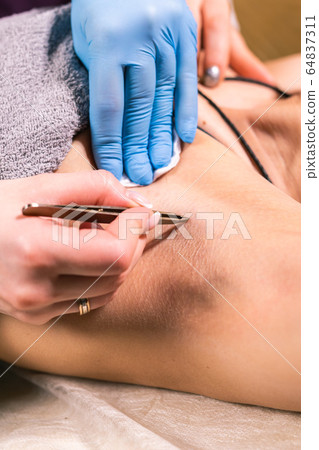 Close-up of removing armpit hair with tweezers. Female depilation. Cosmetology and beauty shop concept. 64837311