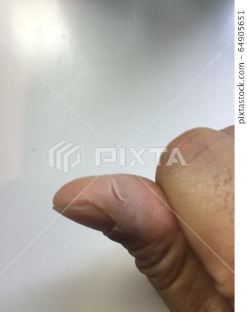 用玻璃劃傷手指的划痕 64905651