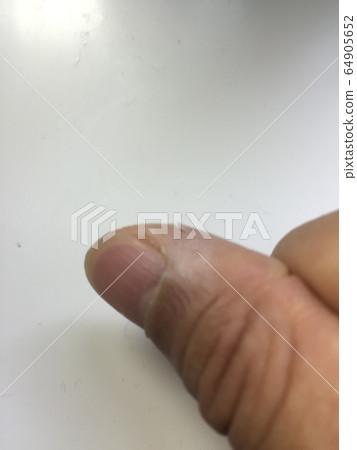 用玻璃劃傷手指的划痕 64905652