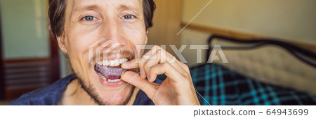 Man placing a bite plate in his mouth to protect his teeth at night from grinding caused by bruxism 64943699