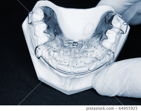 Orthodontic removable retainer. Dental braces 64955925